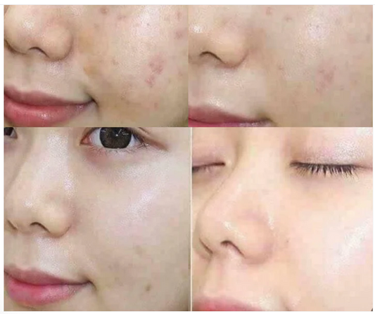 SKIN 1004 Madagascar Centella Ampoule | Sérum Réparateur Ultra-Apaisant & Hydratant Légèr