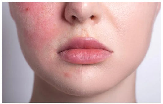 AXIS - Y Dark Spot Correcting Glow Toner | Toner Correcteur Taches & Uniformisant