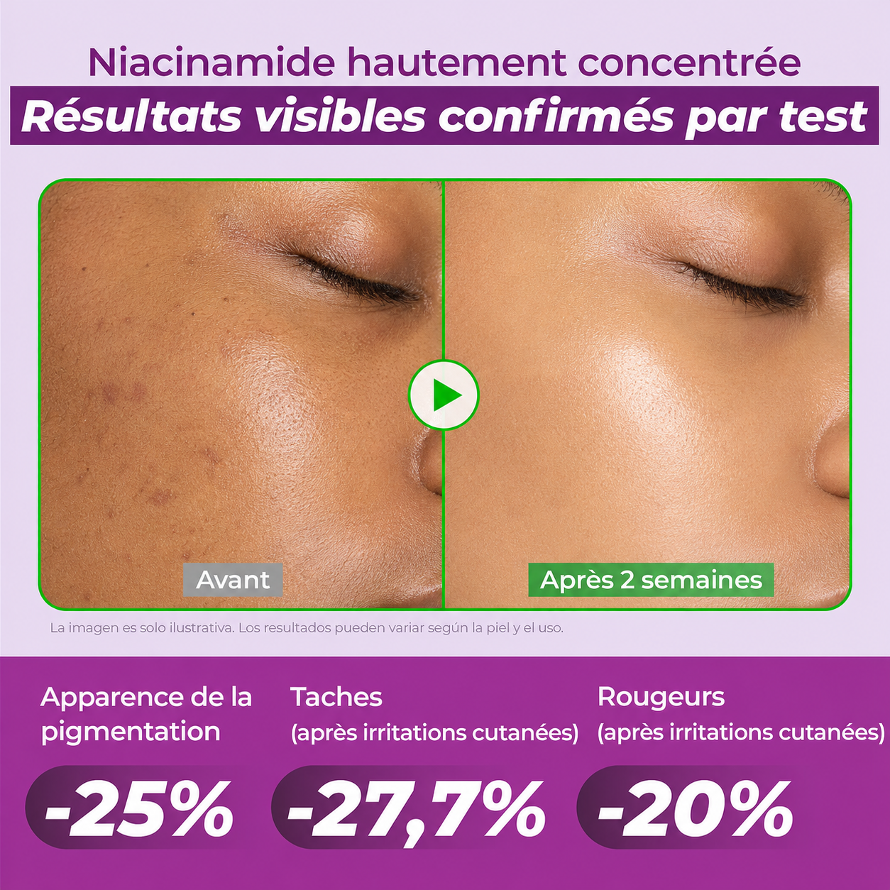 JUMISO Niacinamide 20 Serum | Sérum Haute Concentration Illuminant Anti Taches