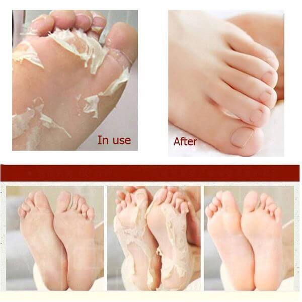 A'PIEU Soft Foot 30 Minute Peeling Socks | Chaussettes Exfoliantes Intensives Pieds Lisses