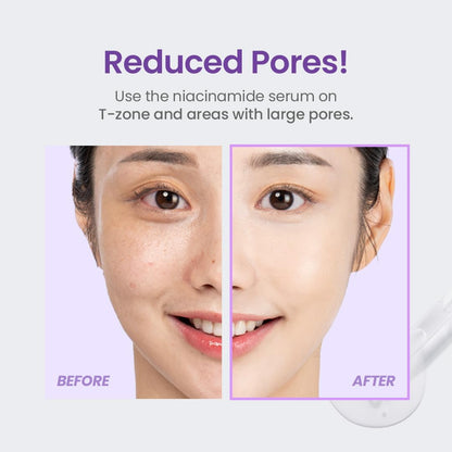 TIRTIR Niacinamide 20% Serum | Sérum Niacinamide Hautement Concentré Anti-tache & Imperfections