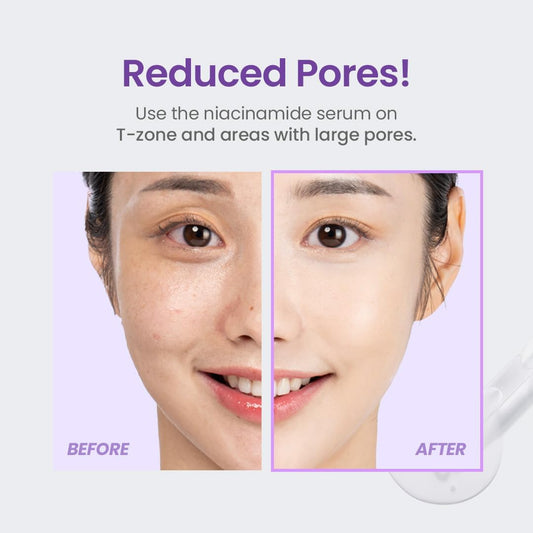 TIRTIR Niacinamide 20% Serum | Sérum Niacinamide Hautement Concentré Anti-tache & Imperfections