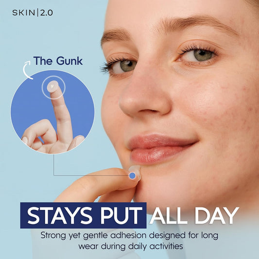 SKIN 2.0 Hydrocolloid Invisible Spot Patch | Patch Réparateur Invisible