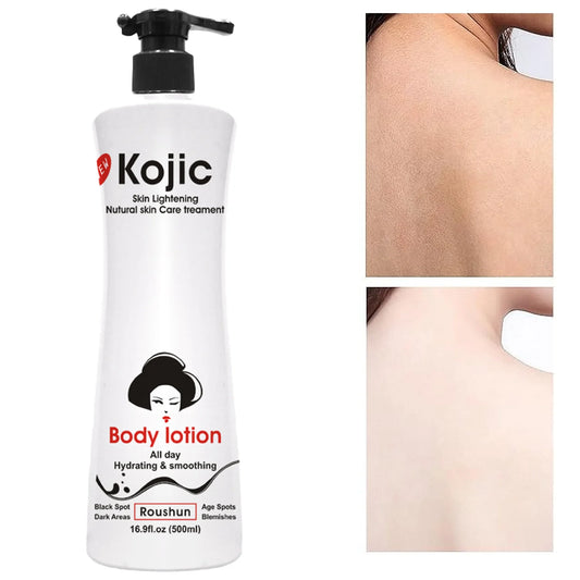 KOJIE SAN Kojic Skin Lightening Body Lotion | Lotion Eclaircissante Uniformisante Lissante
