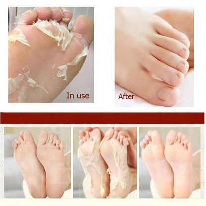 A'PIEU Soft Foot 30 Minute Peeling Socks | Chaussettes Exfoliantes Intensives Pieds Lisses
