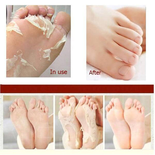 A'PIEU Soft Foot 30 Minute Peeling Socks | Chaussettes Exfoliantes Intensives Pieds Lisses